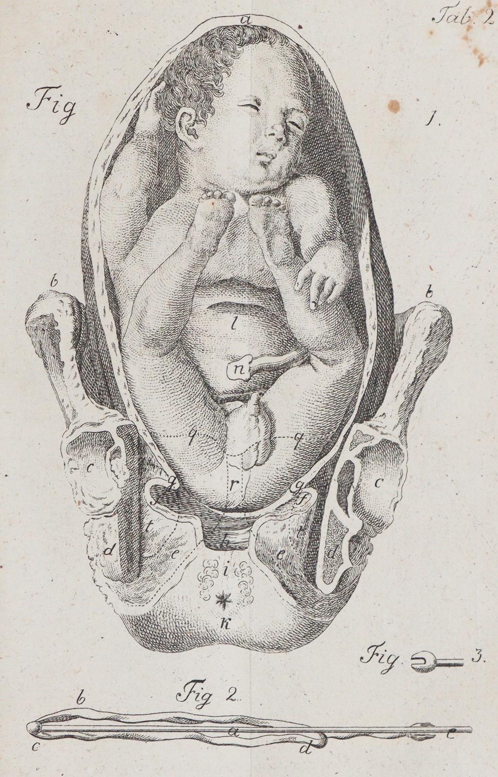 Stein,G.W. | Bild Nr.2