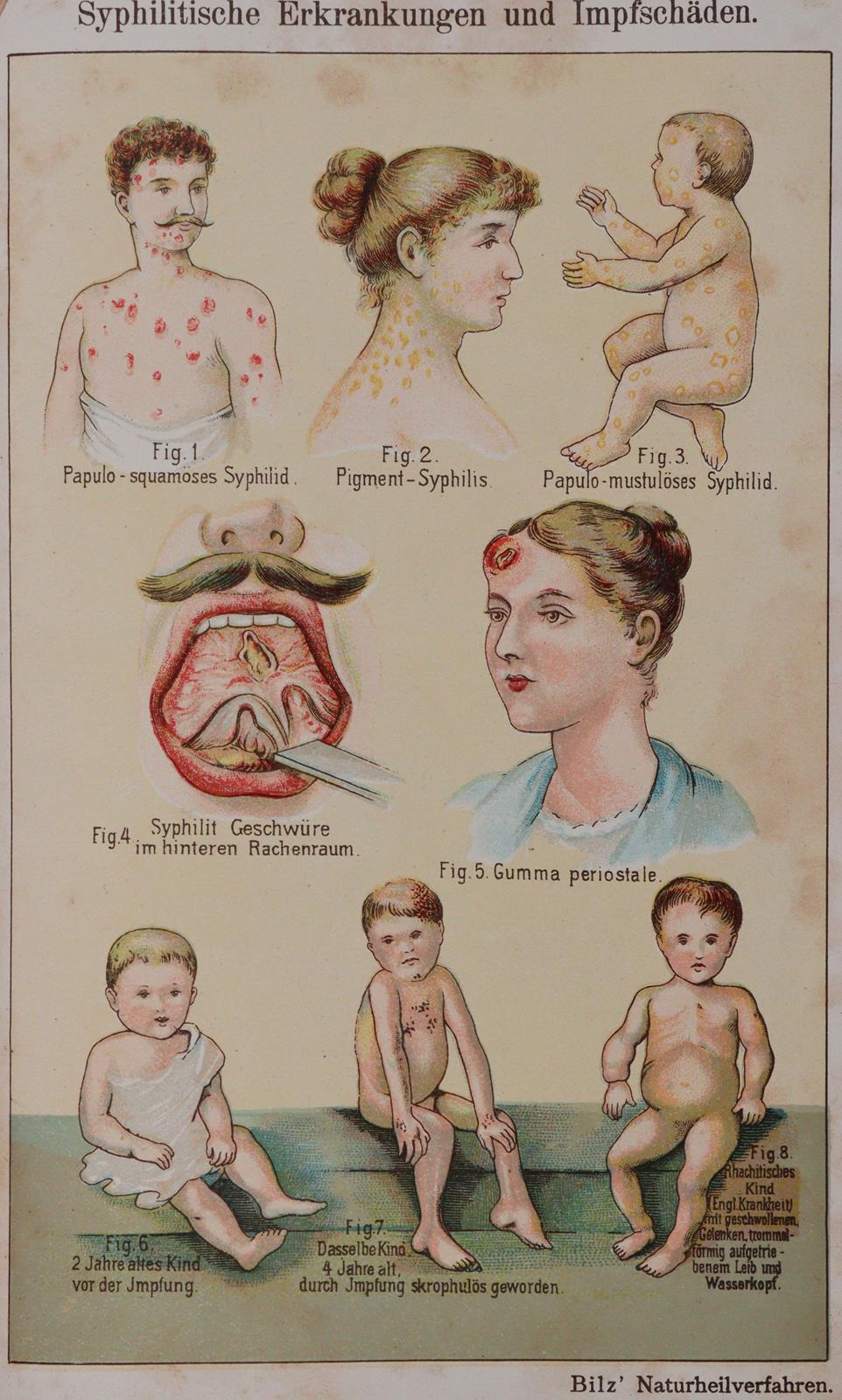 Sammlung | Bild Nr.2