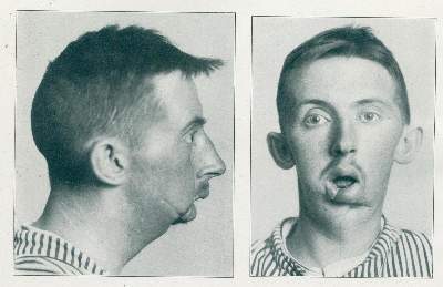Bild Nr.1: 120-982 Röntgen-Atlas: (Medizin, Chirurgie)