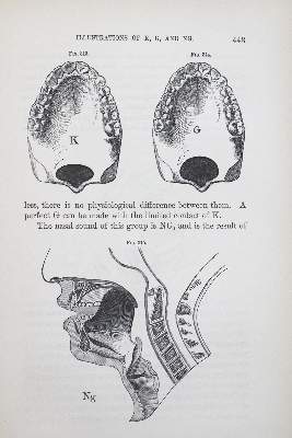 Bild Nr.1: 123-1436 Kingsley,N.W.: (Medizin, Zahnheilkunde)