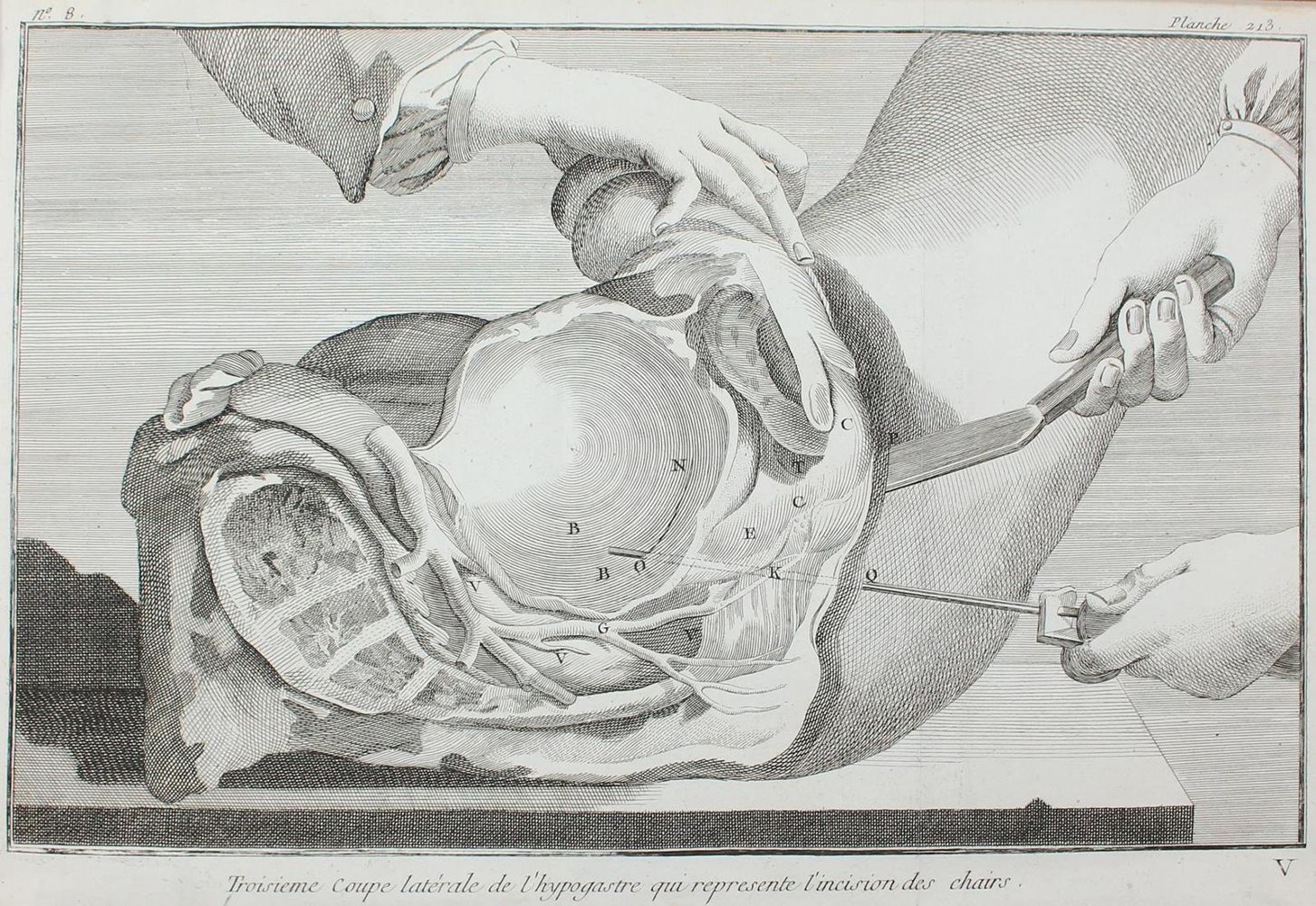 Große Abbildung Nr.3: 124-1475 Chirurgie.: (Medizin)