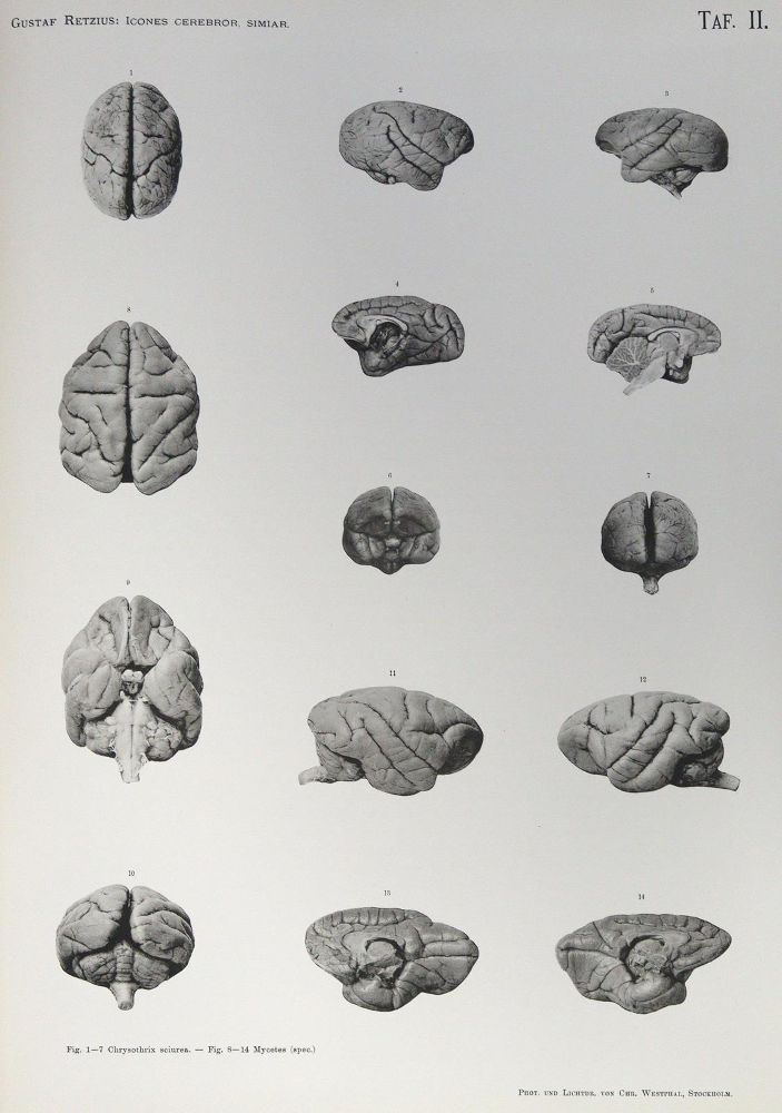 Große Abbildung Nr.2: 124-1501 Retzius,G. (Hrsg.).: (Medizin)