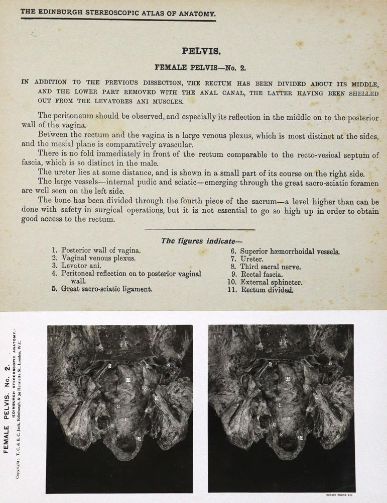 Große Abbildung Nr.2: 125-1509 Waterston,D. u. E.Burnet.: (Medizin, Anatomie)