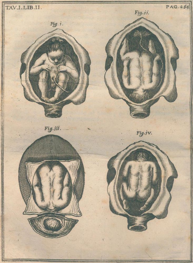 Große Abbildung Nr.1: 125-1558 Melli,S.: (Medizin, Gynäkologie)