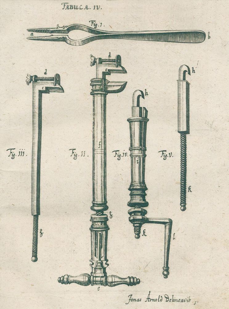 Große Abbildung Nr.5: 125-1618 Scultetus (Schultes),J.: (Medizin)