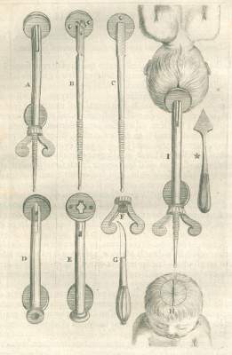 Bild Nr.1: 125-1557 Mauriceau,F.: (Medizin, Gynäkologie)