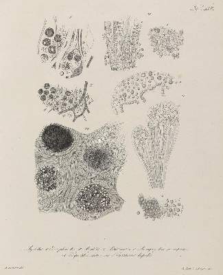 Bild Nr.1: 125-1575 Förster,A.: (Medizin, Mikroskopie, Anatomie)