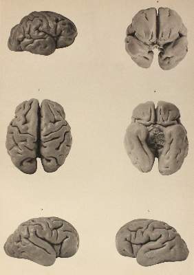 Bild Nr.2: 125-1608 Retzius,G.: (Medizin)