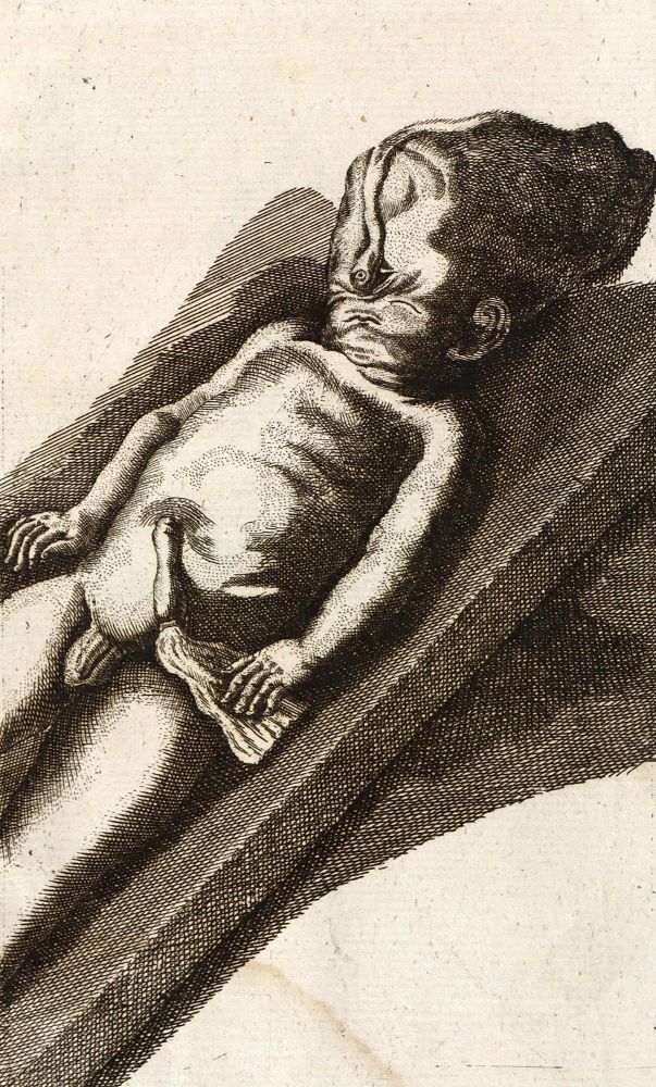 Große Abbildung Nr.1: 126-101 Eller,J.T.: (Aus der Sammlung Professor Dr.Dr.Johannes Büttner Teil 1)