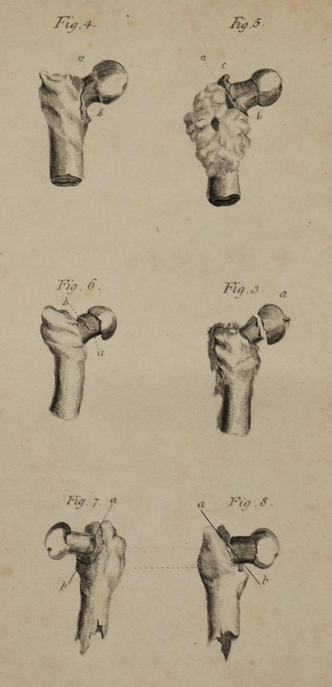 Große Abbildung Nr.2: 126-83 Cross,J.: (Aus der Sammlung Professor Dr.Dr.Johannes Büttner Teil 1)