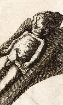 Bild Nr.1: 126-101 Eller,J.T.: (Aus der Sammlung Professor Dr.Dr.Johannes Büttner Teil 1)