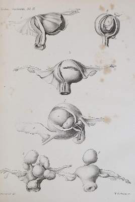 Bild Nr.1: 126-355 Virchow,R.: (Aus der Sammlung Professor Dr.Dr.Johannes Büttner Teil 1)