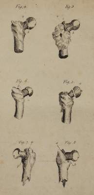 Bild Nr.2: 126-83 Cross,J.: (Aus der Sammlung Professor Dr.Dr.Johannes Büttner Teil 1)
