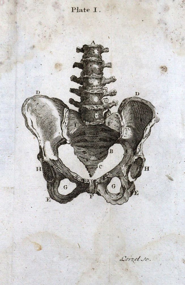 Große Abbildung Nr.2: 127-1492 Smellie,W.: (Medizin, Gynäkologie)