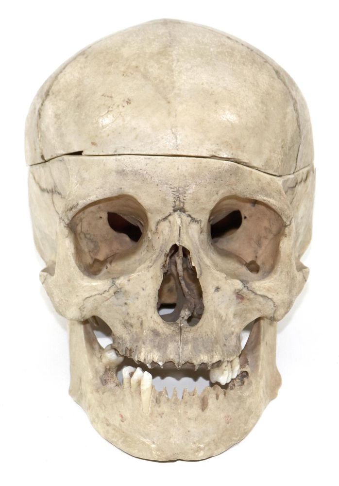 Große Abbildung Nr.1: 127-1503 Totenkopf.: (Medizin, Schädel)
