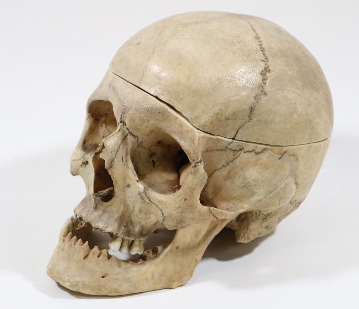 Große Abbildung Nr.2: 127-1503 Totenkopf.: (Medizin, Schädel)