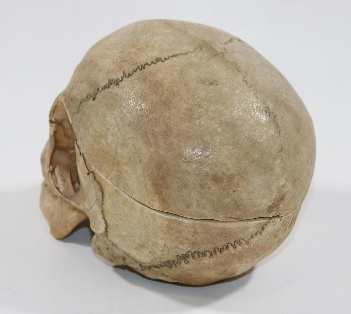 Große Abbildung Nr.3: 127-1503 Totenkopf.: (Medizin, Schädel)