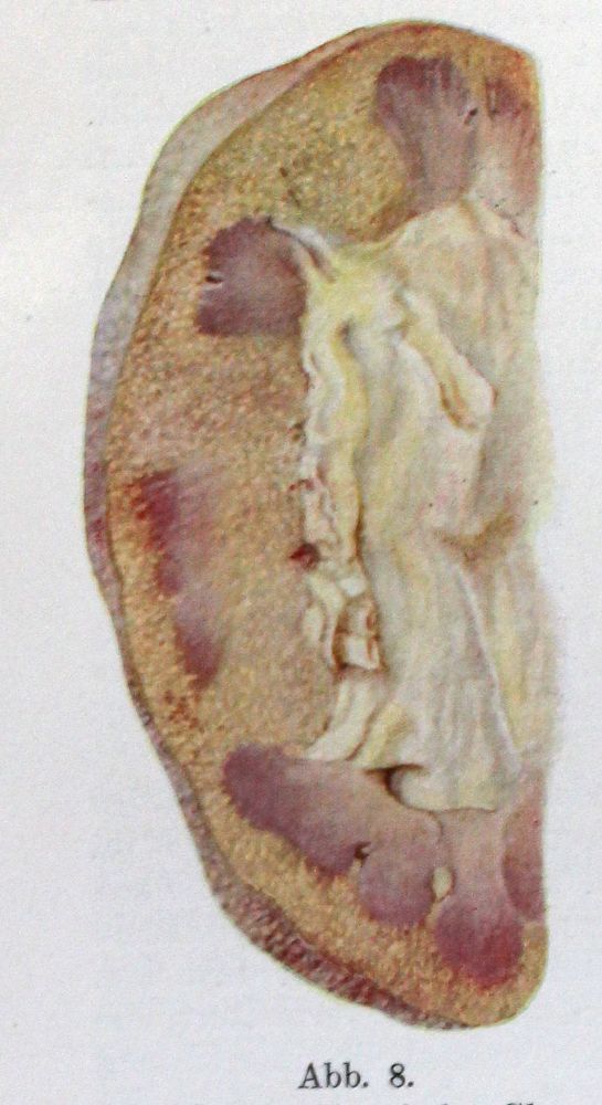 Große Abbildung Nr.2: 127-350 Nephrologie.: (Aus der Sammlung Professor Dr.Dr.Johannes Büttner Teil 1)