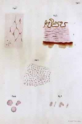 Bild Nr.2: 127-146 Galle.: (Aus der Sammlung Professor Dr.Dr.Johannes Büttner Teil 1)
