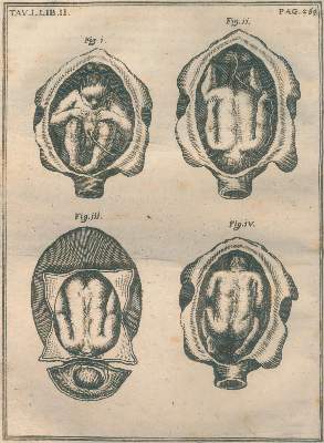 Bild Nr.1: 127-1491 Melli,S.: (Medizin, Gynäkologie)