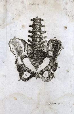 Bild Nr.2: 127-1492 Smellie,W.: (Medizin, Gynäkologie)