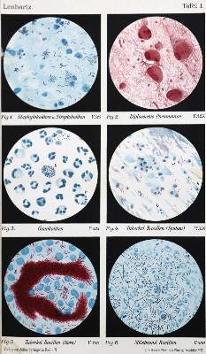 Bild Nr.1: 127-329 Mikroskopie.: (Aus der Sammlung Professor Dr.Dr.Johannes Büttner Teil 1)