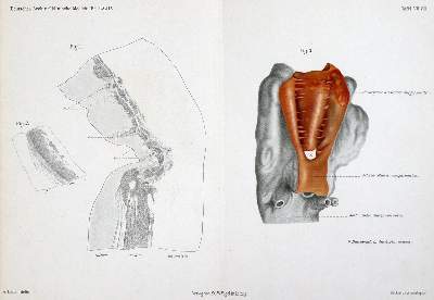 Bild Nr.2: 127-335 Morawitz,P.: (Aus der Sammlung Professor Dr.Dr.Johannes Büttner Teil 1)