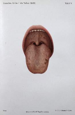 Bild Nr.4: 127-335 Morawitz,P.: (Aus der Sammlung Professor Dr.Dr.Johannes Büttner Teil 1)