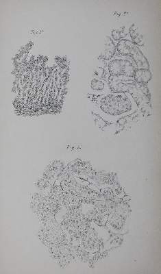 Bild Nr.1: 127-346 Nasse,O.: (Aus der Sammlung Professor Dr.Dr.Johannes Büttner Teil 1)