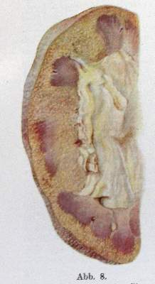 Bild Nr.2: 127-350 Nephrologie.: (Aus der Sammlung Professor Dr.Dr.Johannes Büttner Teil 1)