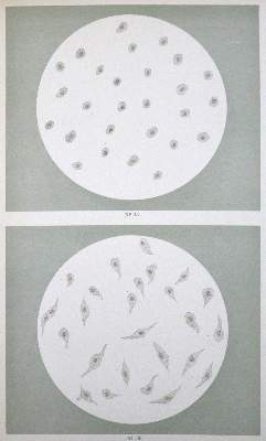 Bild Nr.2: 127-480 Urognostik.: (Aus der Sammlung Professor Dr.Dr.Johannes Büttner Teil 1)