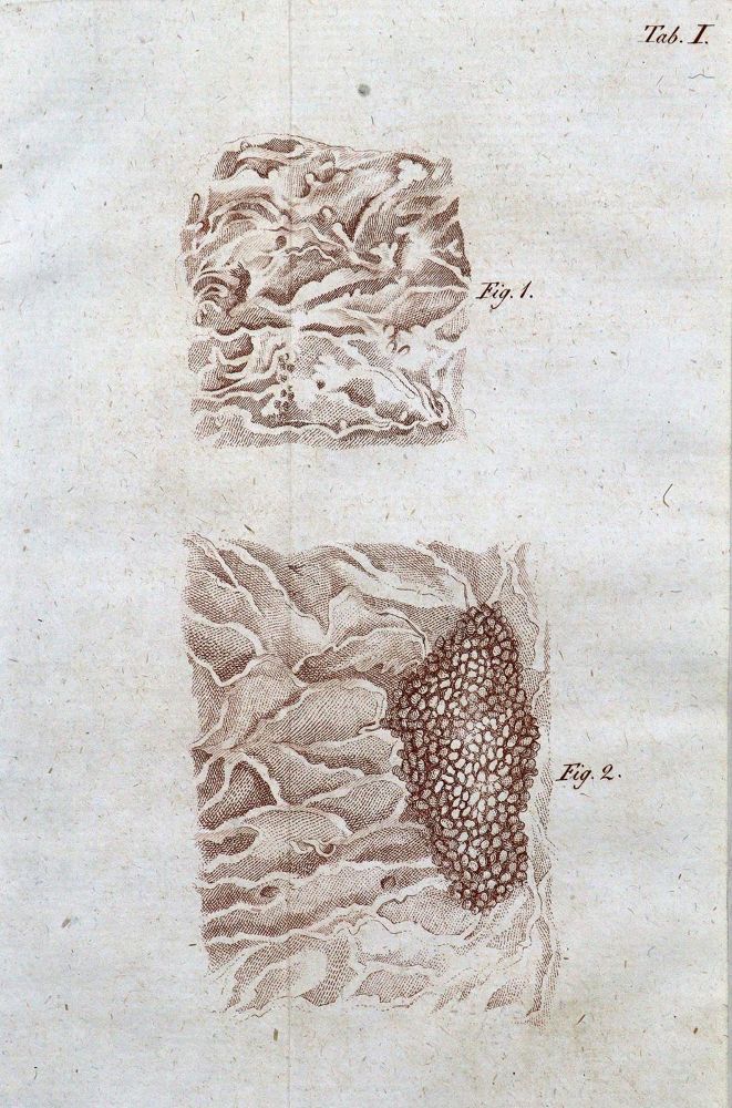 Große Abbildung Nr.2: 128-215 Rudolphi,K.A.: (ZZRückgänge Sgl. Prof. Büttner Teil 1 und 2)