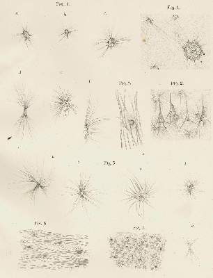 Bild Nr.1: 128-1848 Golgi,C.: (Medizin)