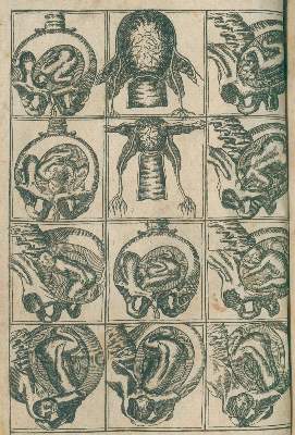 Bild Nr.1: 128-1849 Deventer,H.: (Medizin, Gynäkologie)