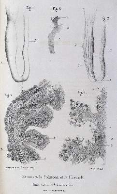 Bild Nr.2: 128-214 Richet,C.: (ZZRückgänge Sgl. Prof. Büttner Teil 1 und 2)