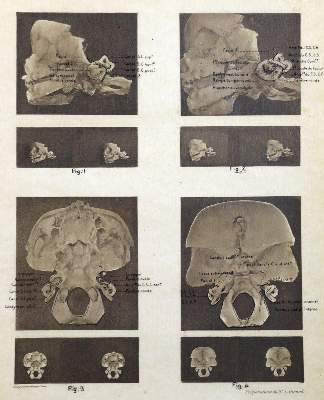 Bild Nr.2: 129-1387 Girard,L.: (Medizin)
