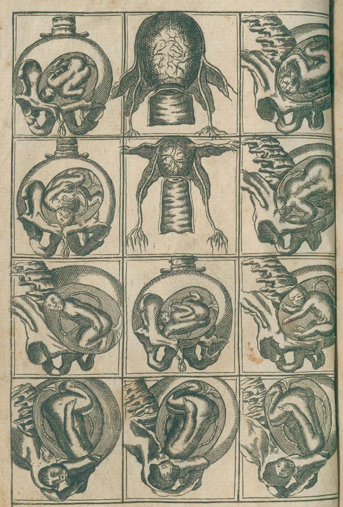 Große Abbildung Nr.1: 130-1735 Deventer,H.: (Medizin, Gynäkologie)