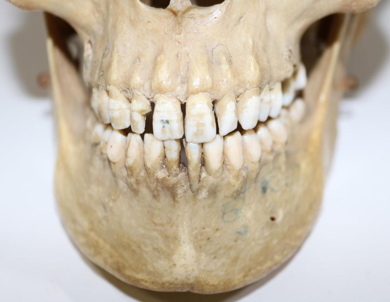 Große Abbildung Nr.4: 130-1766 Totenkopf.: (Medizin)