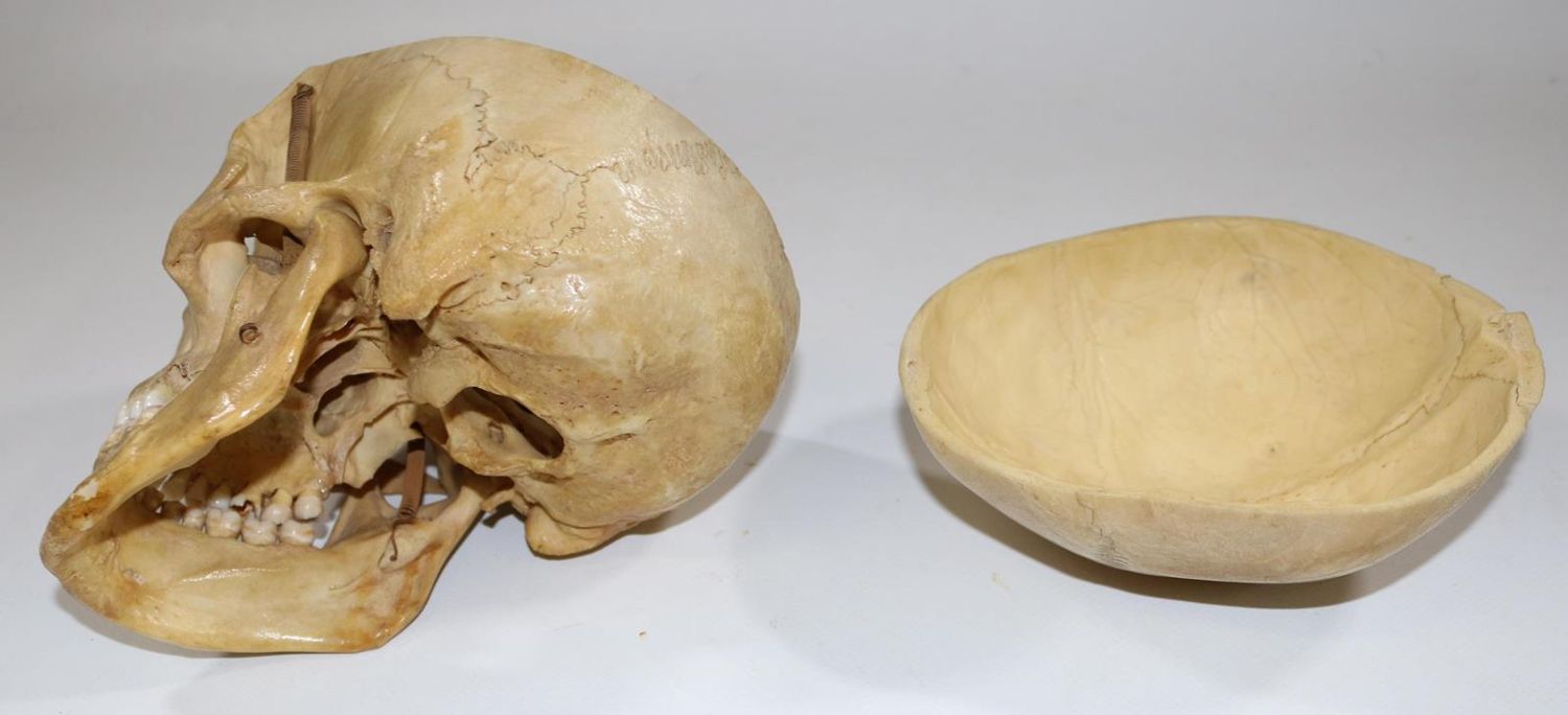Große Abbildung Nr.5: 130-1766 Totenkopf.: (Medizin)