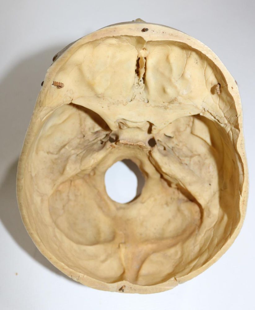 Große Abbildung Nr.7: 130-1766 Totenkopf.: (Medizin)