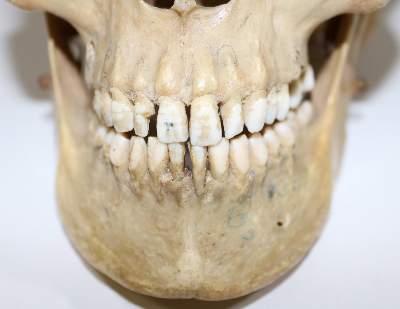 Bild Nr.4: 130-1766 Totenkopf.: (Medizin)