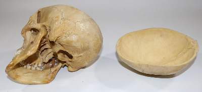 Bild Nr.5: 130-1766 Totenkopf.: (Medizin)