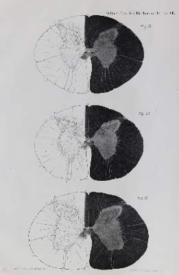 Bild Nr.1: 131-1369 Stilling, B.: (Medizin)