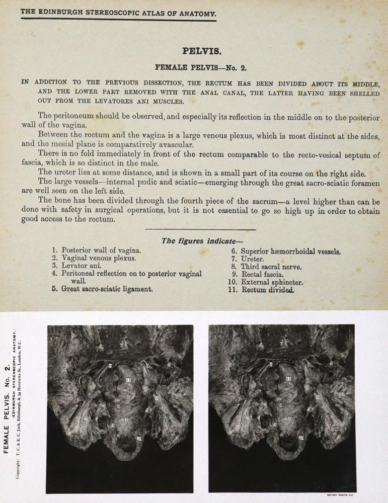 Große Abbildung Nr.2: 132-1346 Waterston,D. u. E.Burnet.: (Medizin, Anatomie)
