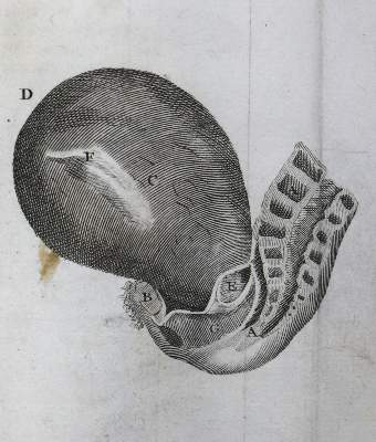 Bild Nr.1: 132-1361 Baudelocque,J.L.: (Medizin, Gynäkologie)