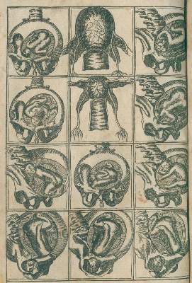 Bild Nr.1: 132-1362 Deventer,H.: (Medizin, Gynäkologie)