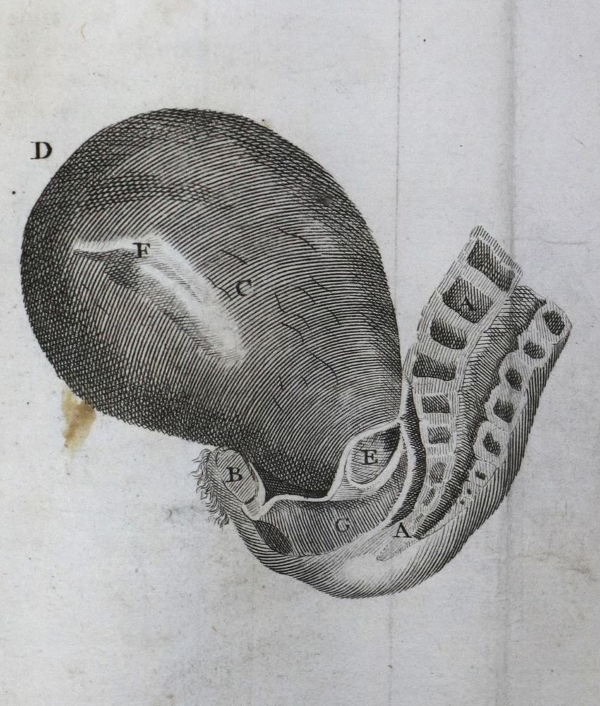 Große Abbildung Nr.1: 133-1202 Baudelocque,J.L.: (Medizin, Gynäkologie)