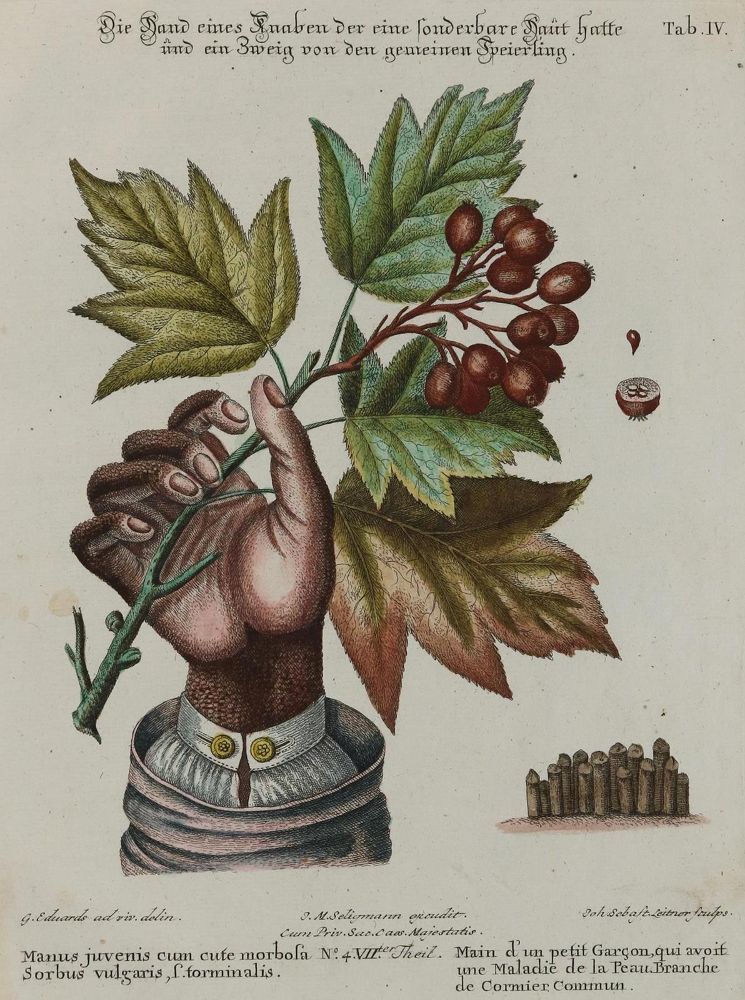 Große Abbildung Nr.1: 133-1205 Hand.: (Medizin)
