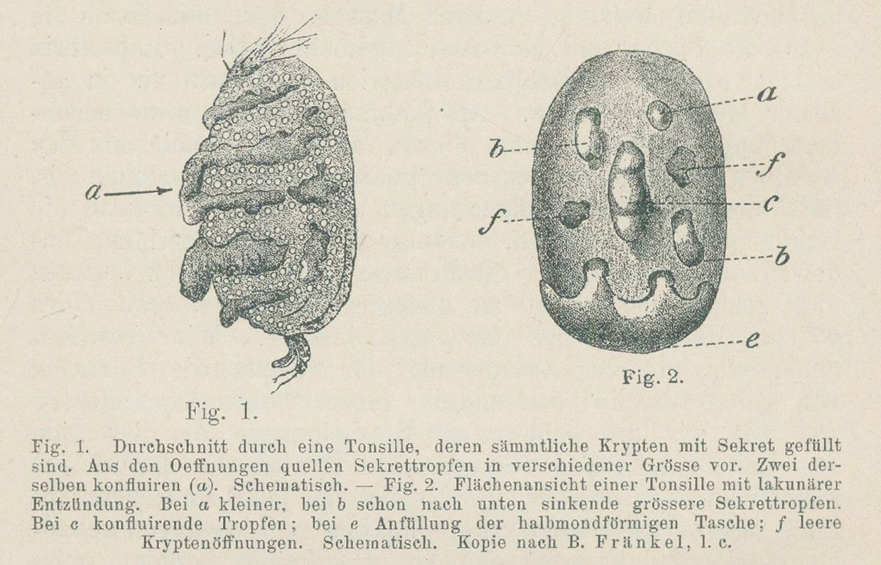 Große Abbildung Nr.2: 134-1405 Bering,E.v.: (Medizin)