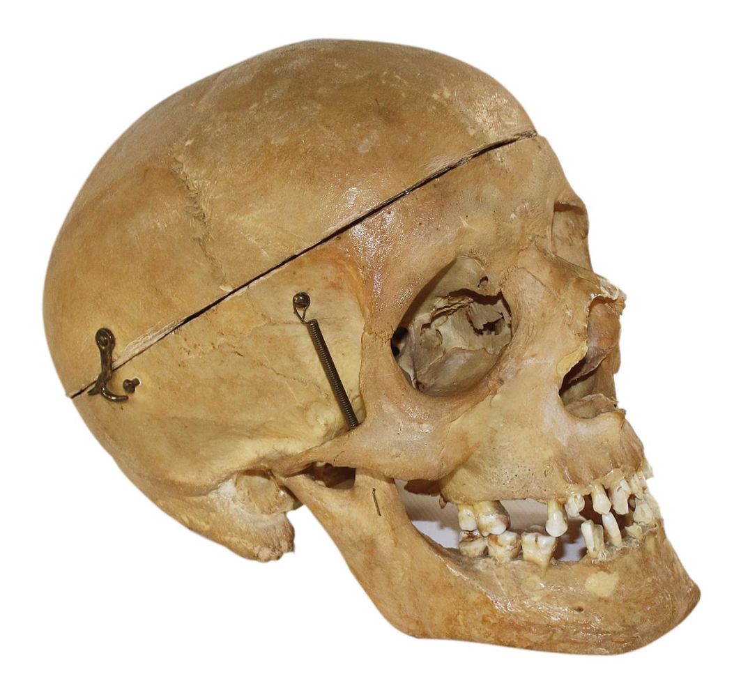 Große Abbildung Nr.1: 134-1454 Totenschädel,: (Medizin)